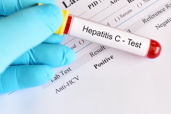 Hepatitis-Screening bei Check-ups 